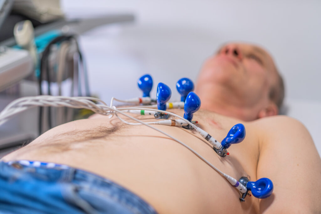 medicina interna pascani electrocardiograma EKG